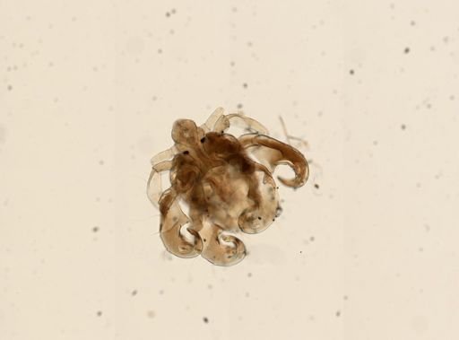 Pthirus pubis