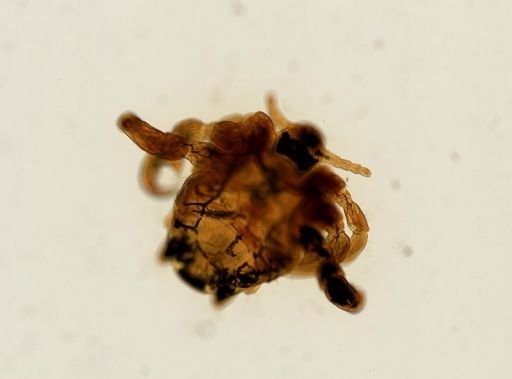 Pthirus pubis