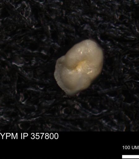undet. Foraminiferida