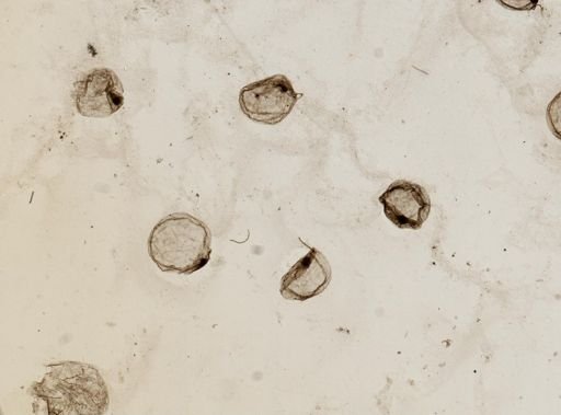 Noctiluca