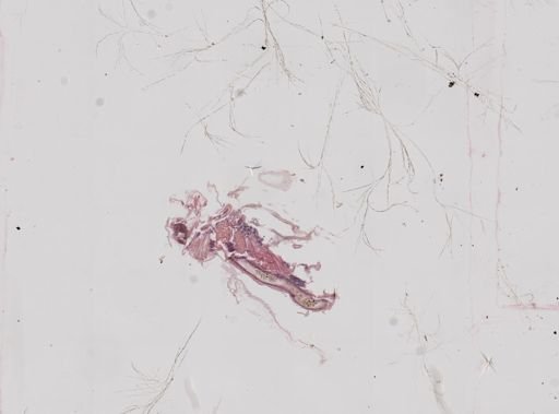 Daphnia