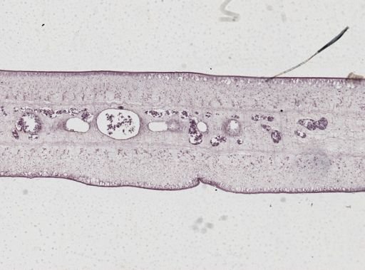 Taenia saginata