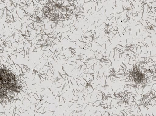 Haliclona oculata
