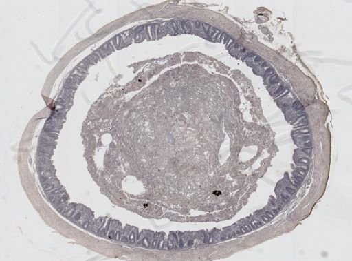 Eimeria meleagrimitis