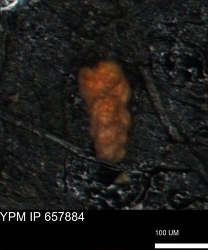 Verneuilina canadensis