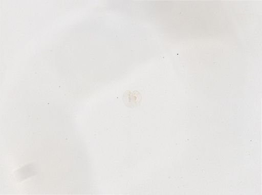 Paramecium