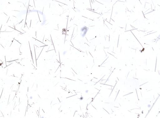Polymastia sp.