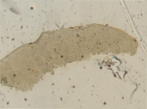 Mycobacterium leprae