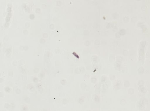 Echinostoma revolutum