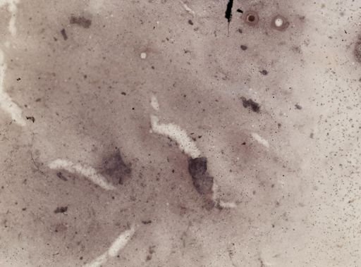Clepsidrina polymorpha