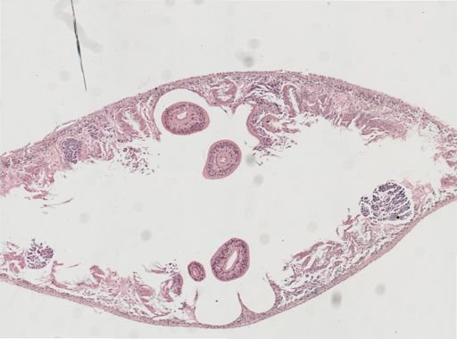 Phagocata gracilis