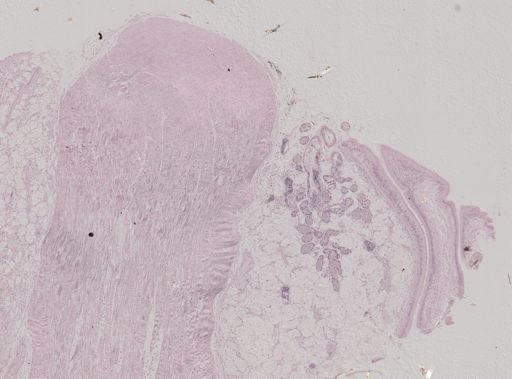 Modiolus