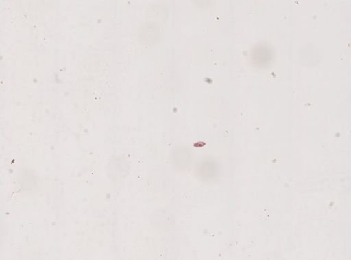 Paramecium