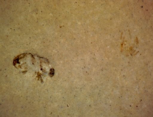 undet. Hexapoda