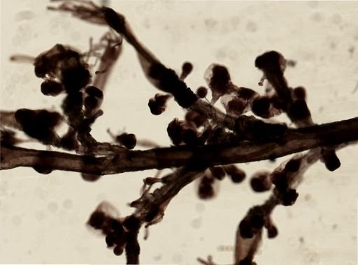 Hydroidolina