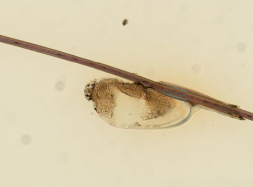 Pediculus humanus
