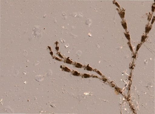 Bryozoa