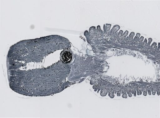 Gastropoda