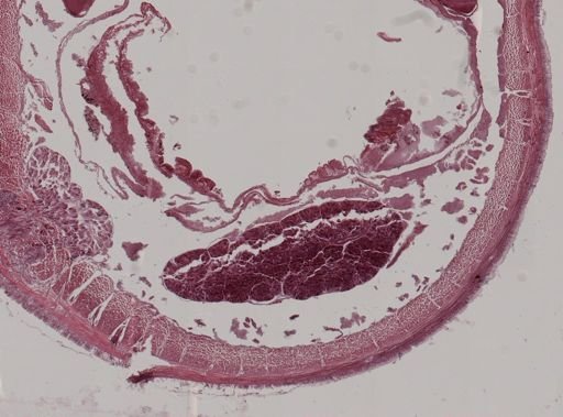 Amynthas heterochaetus
