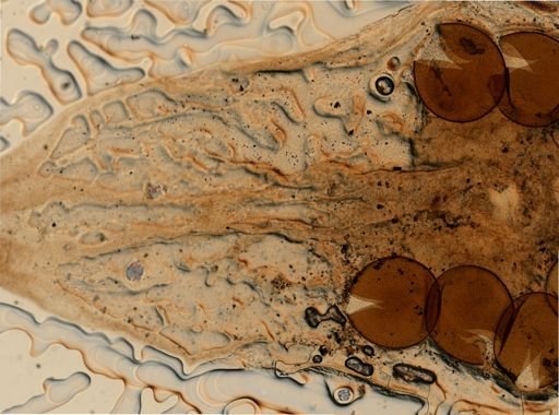 Mesostoma ehrenbergii
