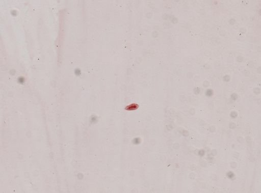 Oxytricha fallax