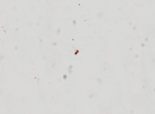Trematoda