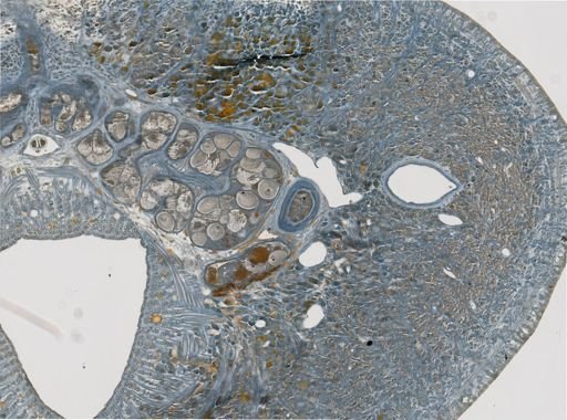 Erpobdella punctata