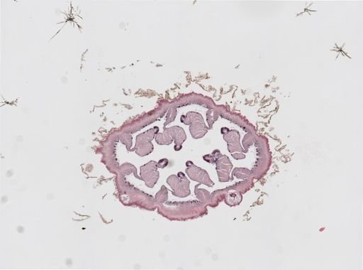 Edwardsia sp.