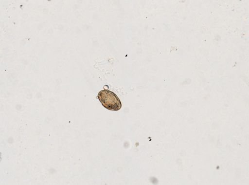 Fasciolopsis buski