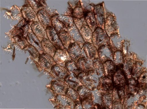 Bryozoa