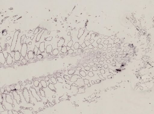 Sycon raphanus