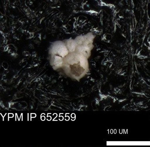 undet. Foraminiferida