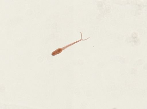 Schistosoma mansoni