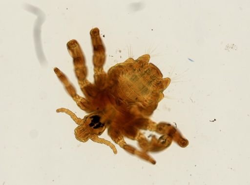 Pthirus pubis