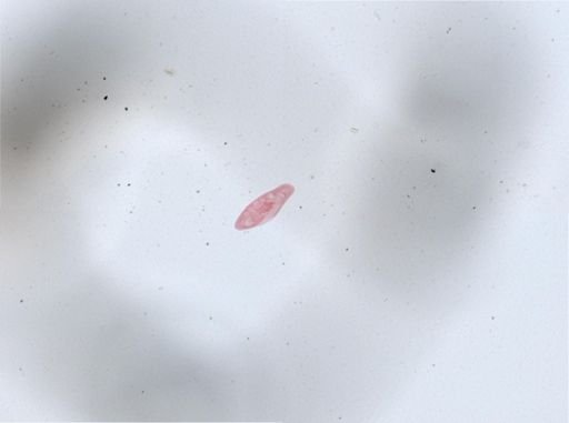 Paramecium aurelia