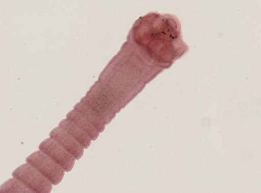 Dipylidium caninum