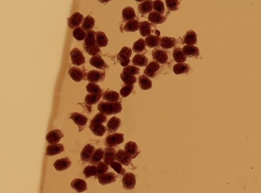 Echinococcus granulosus