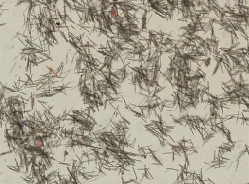 Isodictya deichmannae