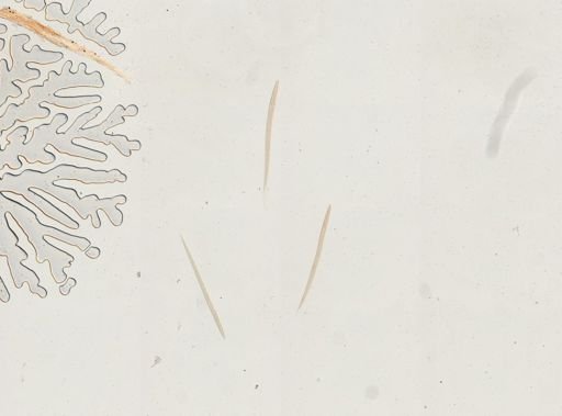 Ancylostoma duodenale