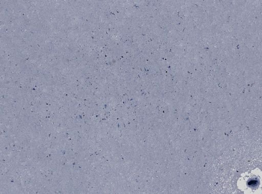 Leucocytozoon