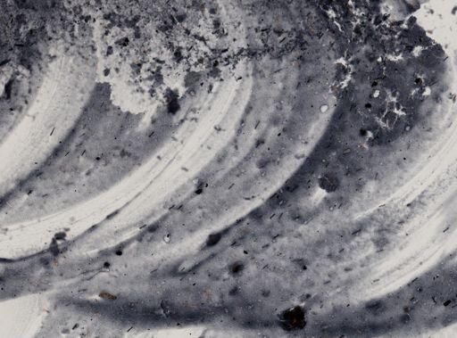Entamoeba histolytica