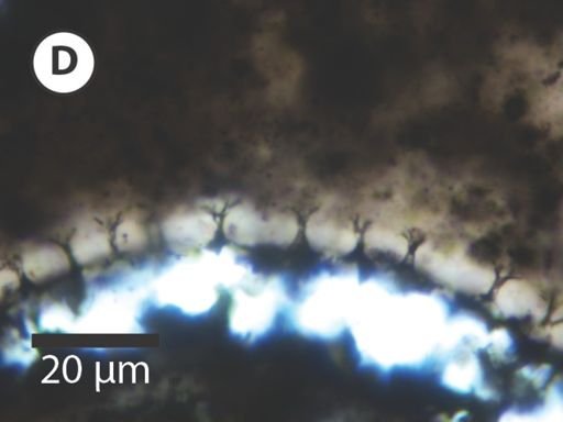 Variomargosphaeridium aculeiparvum