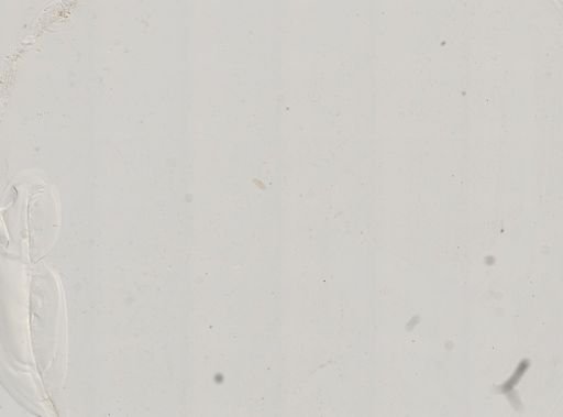 Paramecium