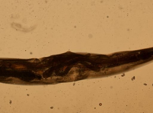 Enterobius vermicularis