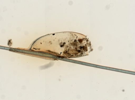 Pediculus humanus