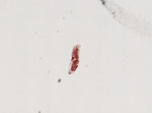Trematoda