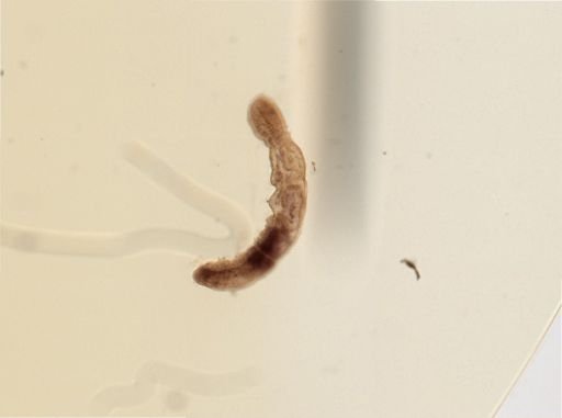 Chaetogaster limnaei