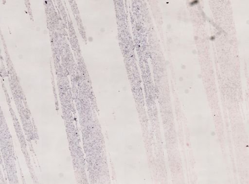 Trypanosoma cruzi