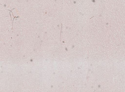 Plasmodium falciparum