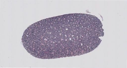 Rana clamitans